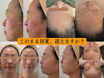 リボーン 柏(REBORN)の写真