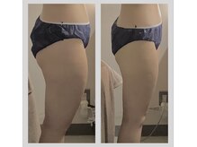 アクア エステティコ 亀有(ACQUA estetico)の雰囲気（キャビテーションやラジオ波で固いセル脂肪にも◎）