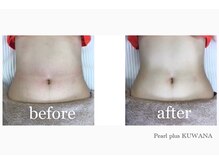 パールプラス 桑名店(Pearl plus)/before / after