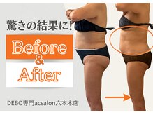 エーシーサロン 六本木店(acsalon)の雰囲気（食事制限一切なし！月１遺伝子エステと神サプリでウエスト-7.5cm）