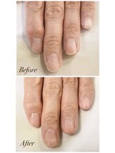 サロンR/地爪保護！カルジェルクリア