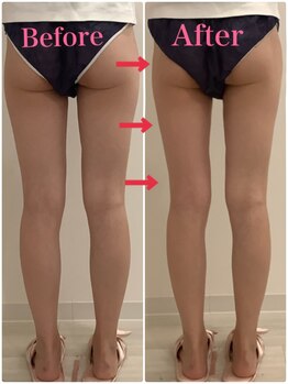 スペチアーレ 夙川/痩せにくい場所におすすめ