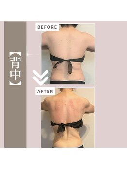 ミックスアップ 池袋店(Mix up!!)/【ブライダル】