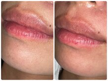 レネット サロン 立川店(Reinette Salon)/フェイスワックス