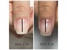 【Hand】美爪育成「クリアネイル」¥6,300