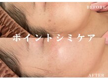 綺麗サロン 脱毛アンドフェイシャル ジュエル(Jewel)の雰囲気（3日後にポロッと取れる感動体験！）