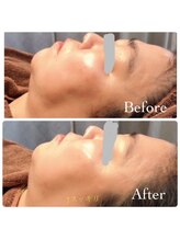 ルナカーザ(LUNACASA)/テラボーラー1回