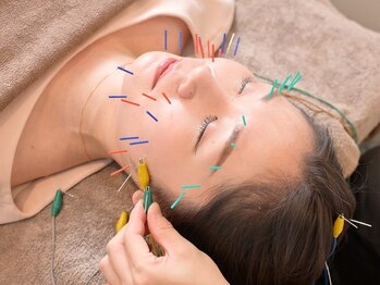 ハリスパ 堀江院の写真/《美容鍼を用いた施術で、理想の小顔へ！》むくみを解消し、お肌もワントーン明るく、印象UP♪美肌効果も◎