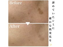 ルタンリッシュ ハナレ(Lutan Riche 花麗)/