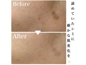 ルタンリッシュ ハナレ(Lutan Riche 花麗)/