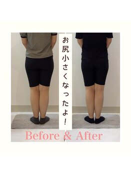 スタイルラボ高松/産後の骨盤矯正の効果♪