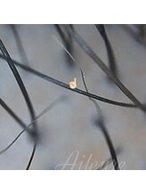 エルール トータルビューティ(Aileure total beauty)/育毛促進メニュー