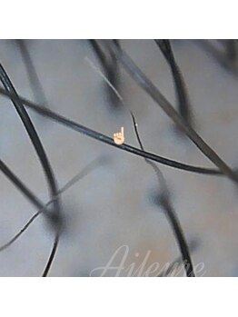 エルール トータルビューティ(Aileure total beauty)/育毛促進メニュー