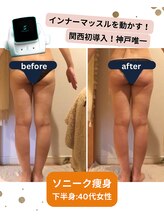 ボディデザインホームクレアフェリーチェ 神戸(Body design home Crea felice)/ソニーク痩身☆ビフォーアフター