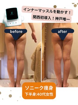 ボディデザインホームクレアフェリーチェ 神戸(Body design home Crea felice)/ソニーク痩身☆ビフォーアフター