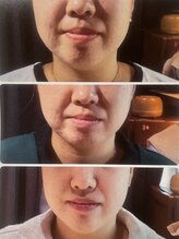 賢者のボディケア/レモンボトル小顔　