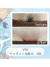 【女性/8/31迄/夏目前!始めるなら今!】VIOワックス+光脱毛2回券