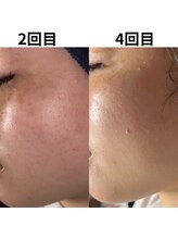 アルビーダ(RBDA)/しみ・くすみ改善は当店にお任せ