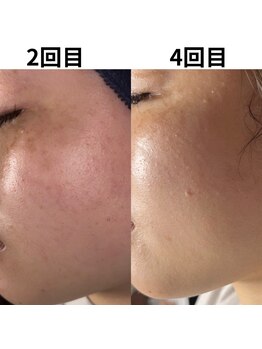 アルビーダ(RBDA)/しみ・くすみ改善は当店にお任せ