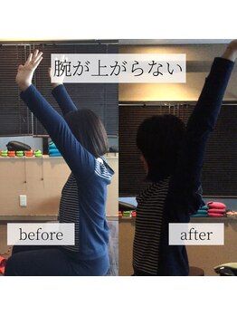 ミーツ(MEETS)/肩こりが凄すぎて頭痛もする 1回