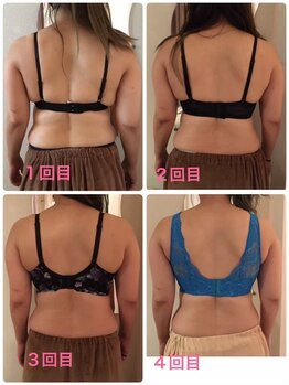 エグゼ アムール エム アンベリーノ 大阪店(Exe amour M)/回数を重ねるごとに綺麗に