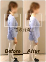 ティーエスエル とがし整体ラボ(TSL とがし整体 Labo)/ブライダル整体/骨盤矯正/反り腰