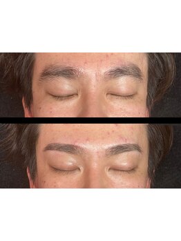 メンズフェイシャル