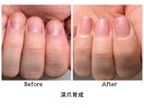 自爪育成/深爪育成/ケア育成/