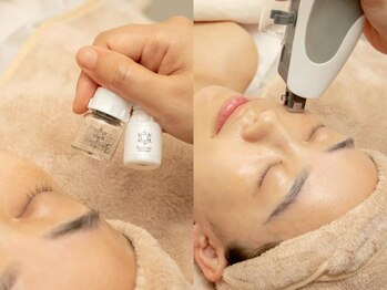 イリジアエリート(inizia elite)/毛穴洗浄+ヒト幹細胞導入