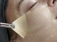 トータルエステ ユキ(YUKI)