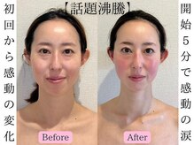 エレミュー 烏丸(Elemue.)の雰囲気（オーナー自身もこの施術で変化を遂げました!）