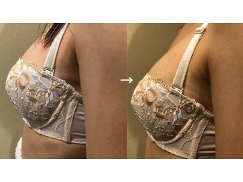 フェイシャル専門サロン サロン ド ウイッシュ/BカップからDカップ～バストUP