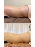 浮き輪肉/美脚引き締めNO1セル脂肪撃退★4次元ボディメイク¥15400→¥8800