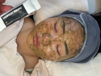 アンナビューティ 六本木 乃木坂店(Anna Beauty)の写真/【結果重視】肌荒れ改善!剥離ありハーブピーリング¥8800~内側から光輝くオーラをまとった美白肌へ...◇