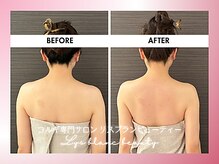 リス ブラン ビューティー(Lys blanc beauty)/９０分コルギBefore×After