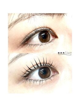 アンフィズム(annfism)/