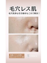 ジヒカ(ZIHICA)/【毛穴徹底洗浄★】
