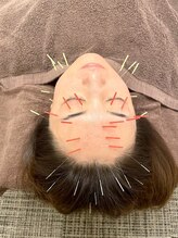 友愛はりきゅう美容整体院/美容鍼+育毛促進鍼