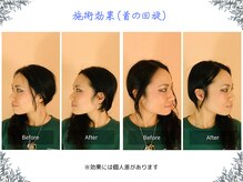 ボディ リセット アンド デザイン(Body Reset & Design)/【施術例】ビフォーアフター