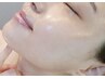 高美肌脱毛・お顔全体お試し