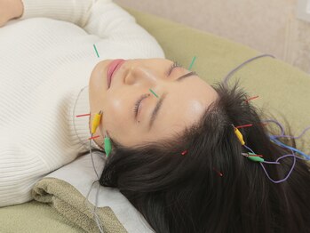 チャンス 西院(chance)/【電気美容鍼】