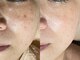ゾーンビューティーハウス 柏店(ZONE BEAUTY HOUSE)の写真
