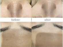 ダリアビューティー(Dahlia Beauty)/アンストレス before after