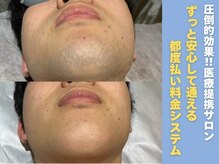 ゆいまーるはうすの雰囲気（メンズ人気No.1！ヒゲ脱毛★毎朝の髭剃りいらずに☆イケメン計画）