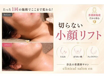 エン 橿原店(en)の写真