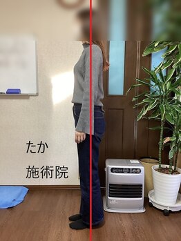 たか施術院/肩こり 背中の痛み &nbsp;ヒップ注目