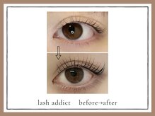 アルセ(arce)/美容液アディクトBefore→After 