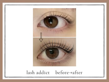 アルセ(arce)/美容液アディクトBefore→After 