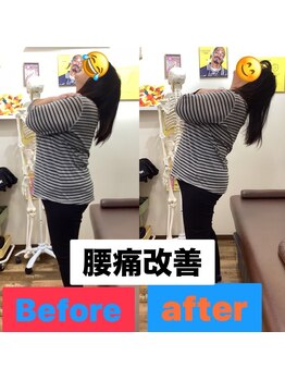 ヒデ整体院(Hide整体院)/猫背矯正骨盤矯正B/A肩こり腰痛