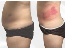 プリマルーチェ/プレミアムお腹プログラム